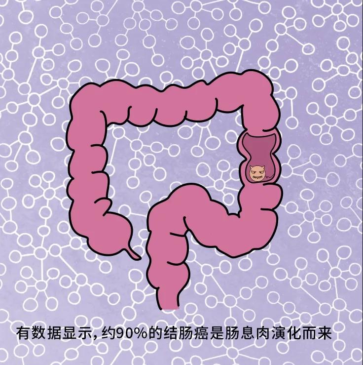 奪走“黑豹”生命的結(jié)腸癌，到底什么來頭？