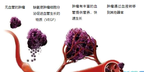 晚期腫瘤為什么會復發(fā)轉(zhuǎn)移？