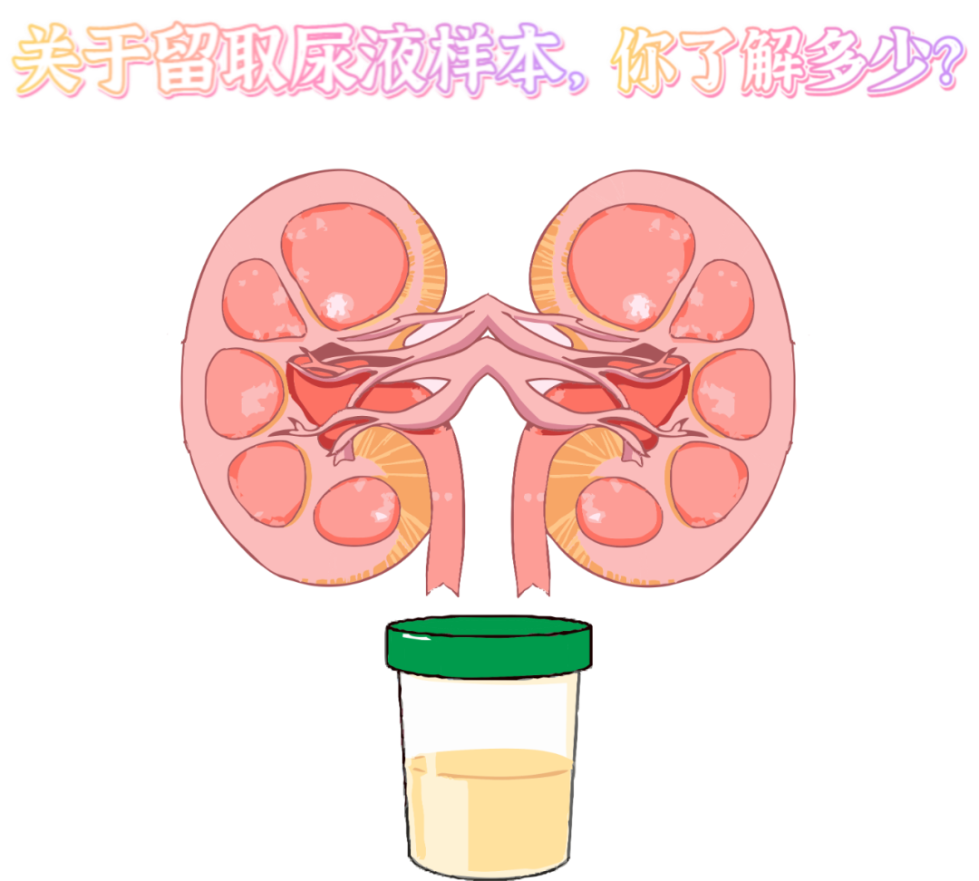 做尿檢，不得不說(shuō)的注意事項(xiàng)！