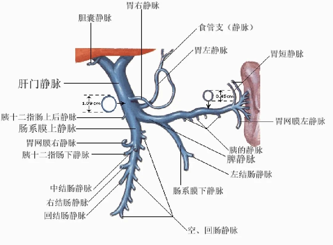 反復(fù)嘔血、黑便怎么辦？TIPS手術(shù)能解決