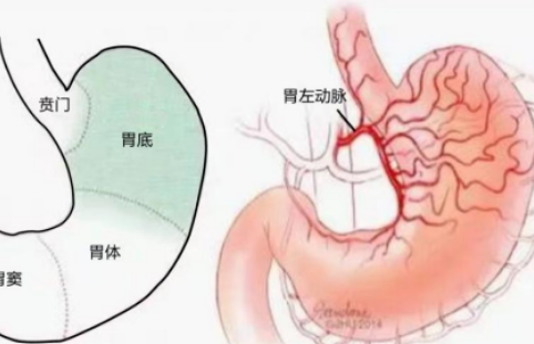 不開刀不吃藥不餓肚子，微創(chuàng)介入減肥靠譜嗎？