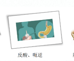 關(guān)愛(ài)身體健康，輕松檢查胃腸