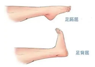 扭胯小連步、動(dòng)感搖花手……“科目三”雖火，運(yùn)動(dòng)損傷也要防！