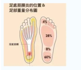 每年新生數(shù)百萬足底筋膜炎患者！國(guó)際醫(yī)學(xué)專家提醒：跑步要選擇合適的鞋