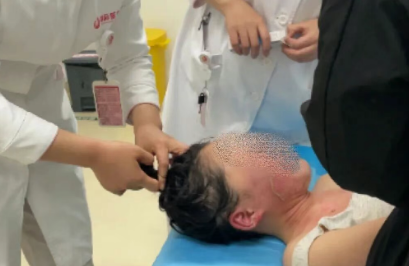 14歲，面、頸、胸燙傷，只因中午那鍋面湯…